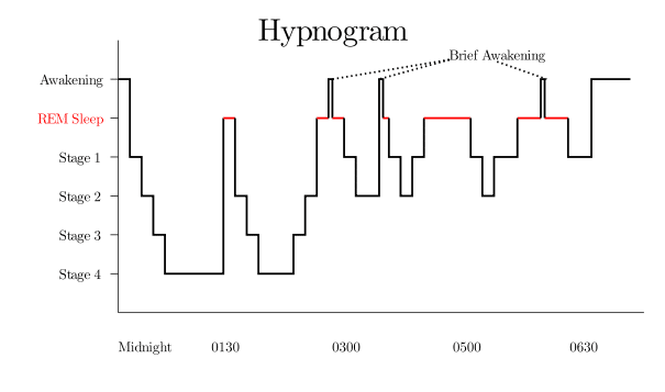 605px-Sleep_Hypnogram.svg