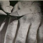 Thumbnail image for Rip Off the Band-Aid!
