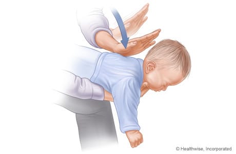 hwkb17_028 how to perform heimlich maneuver on baby infant