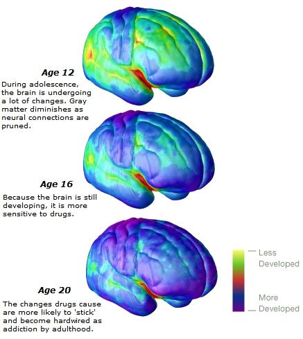 gray matter brain comparison ages 12 16 20