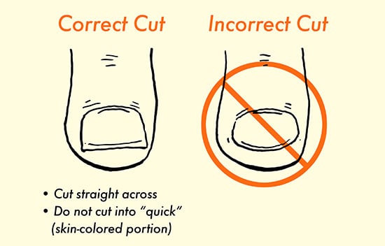 How to properly cut toenails illustration.