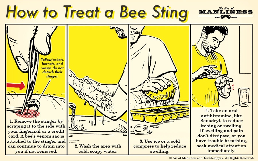 how to treat a bee sting illustration diagram 