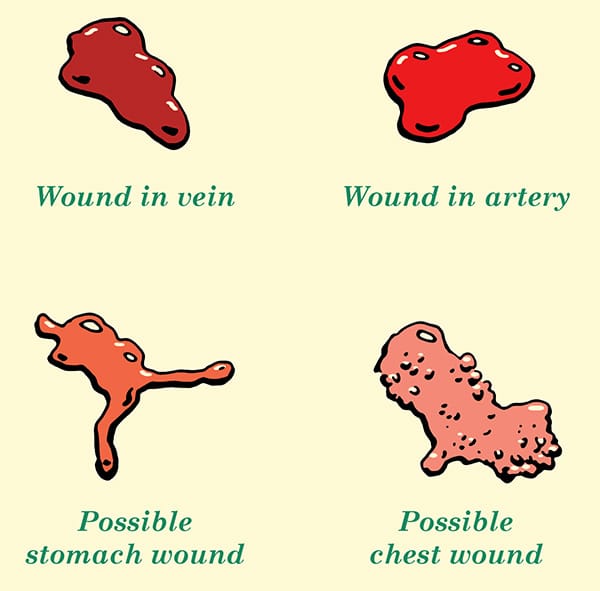Blood indicators what type of wound identification illustration.