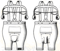 Vintage spermatic truss illustration.