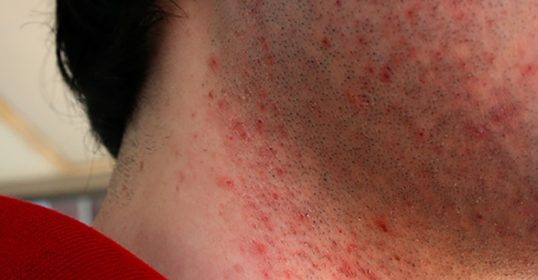 A man in a red shirt.