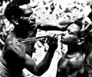 Tribal man doing bloodletting nose of boy.