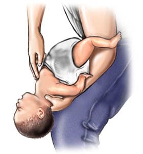 How to perform Heimlich maneuver on infant baby from front side illustration.