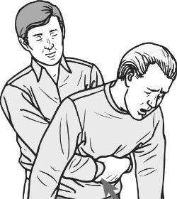 A black and white illustration of a man performing the Heimlich Maneuver on another man in a life-threatening situation.