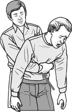 How to Perform the Heimlich Maneuver | The Art of Manliness