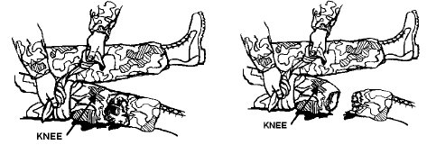 armytourn1 how to apply tourniquet wrap limb with rope belt
