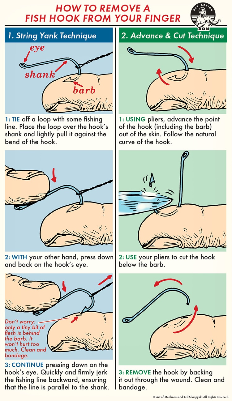 How to Remove a Fish Hook From Hand Like a Pro - Montana Hunting and  Fishing Information