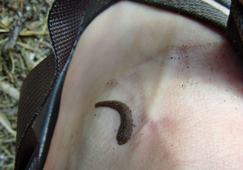 Leech on skin from canoeing bwca Minnesota. 