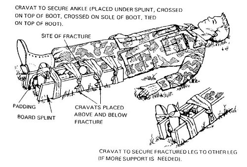 Vintage military manual splinting a leg illustration. 