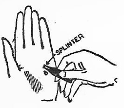 Boy scouts vintage illustration tweezers splinter.