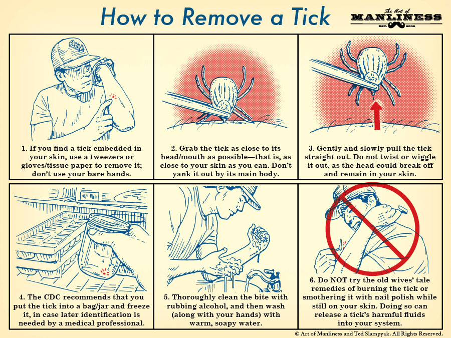A comic guide how to remove a tick.