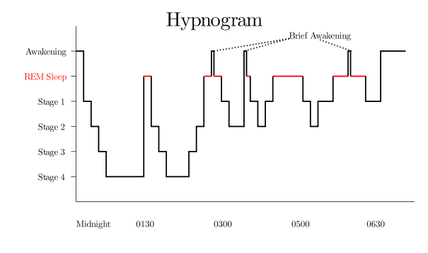 Hypnogram chart of rem sleep cycles. 