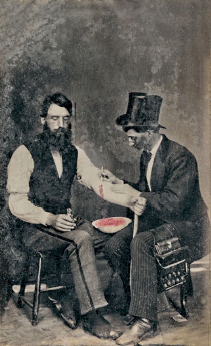 Vintage doctor taking man blood running into bowl. 