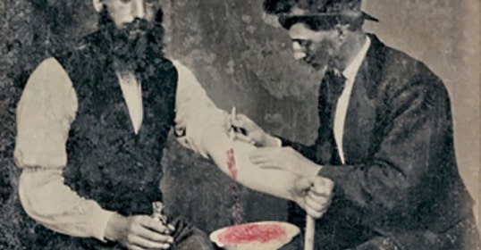 An old photo of a man with a needle in his arm highlights the practice of bloodletting.