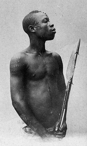 African boy with scars on face body. 