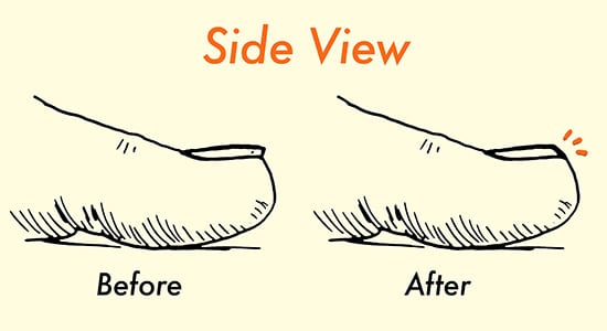 How to properly cut toenails illustration.