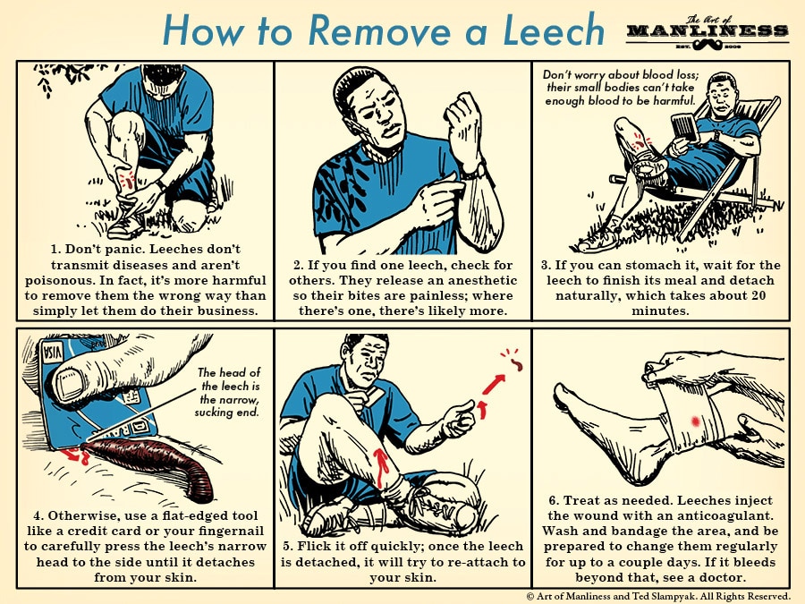 How to Remove a Leech illustration.