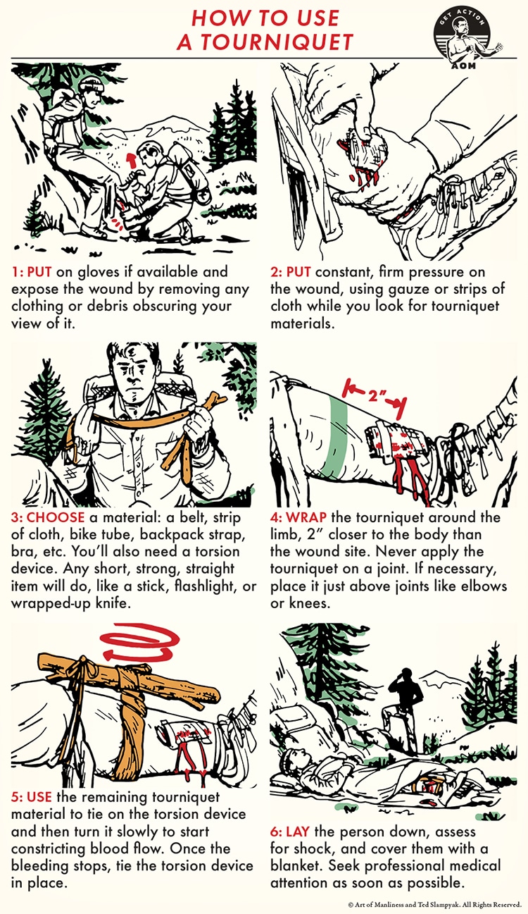 skill-of-the-week-apply-a-tourniquet-the-art-of-manliness-vermont