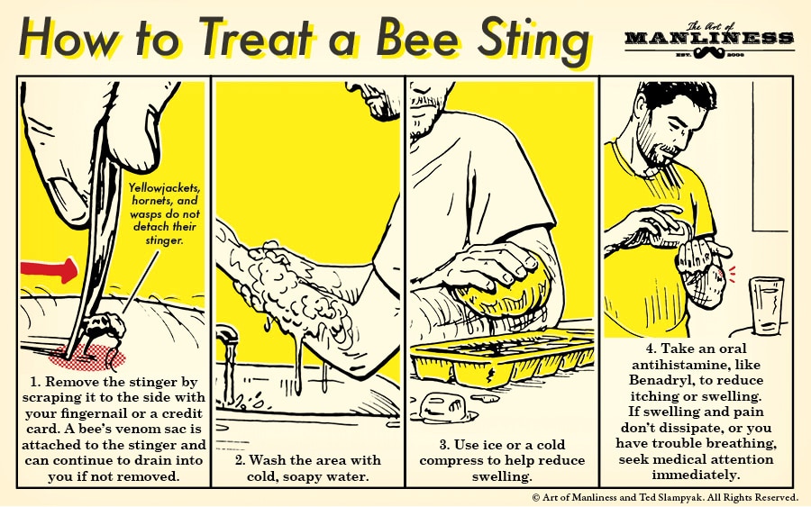 How to treat a bee sting illustration diagram.