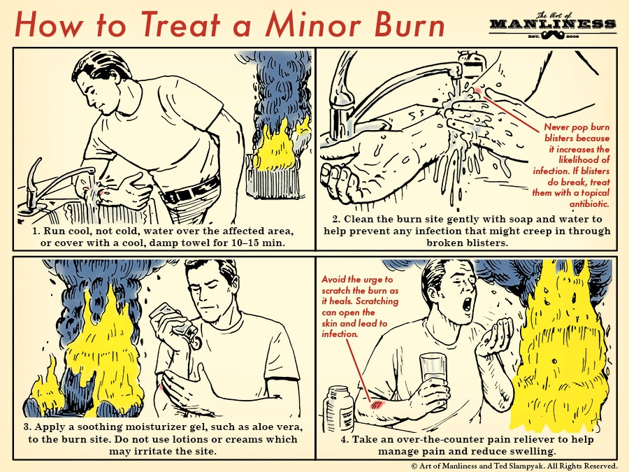 Treating minor cuts and burns at home