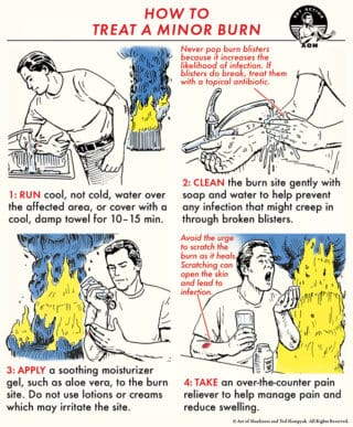 Skill of the Week: How to Treat a Minor Burn | The Art of Manliness