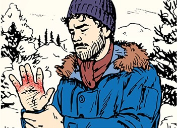 A person in winter clothing appears to be suffering from cold-induced discomfort, possibly frostbite, in their hand against a snowy landscape.