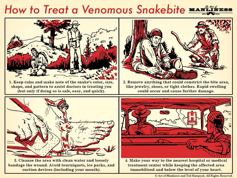 Treatment of a venomous snakebite illustration how to diagram.