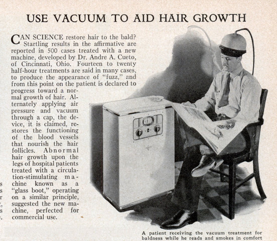 A patient receiving the vacuum treatment for baldness while he reads and smokes in comfort.