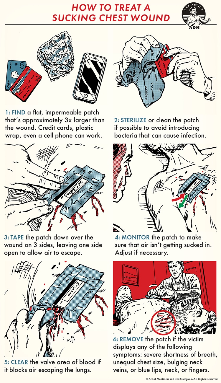 How to Deal With a Sucking Chest Wound Using Duct Tape and a Plastic Bag •  Spotter Up