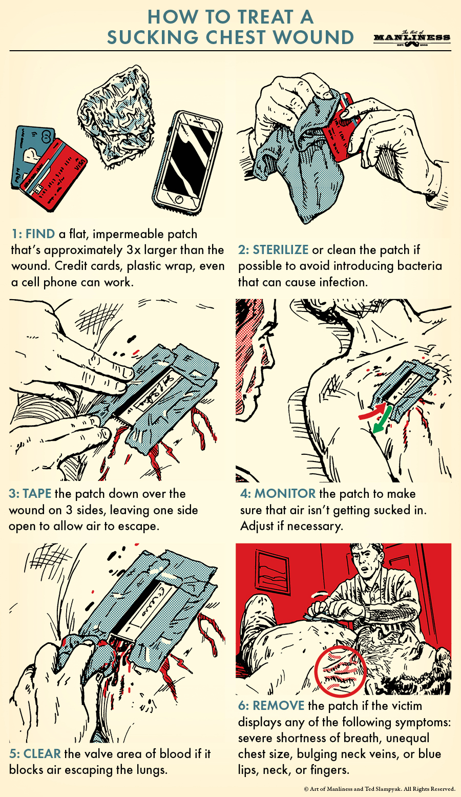Six basic steps to treat a sucking chest wound. 