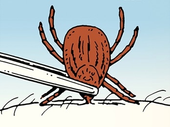 Illustration of the "skill of the week": removing a brown tick from skin using tweezers against a blue background.