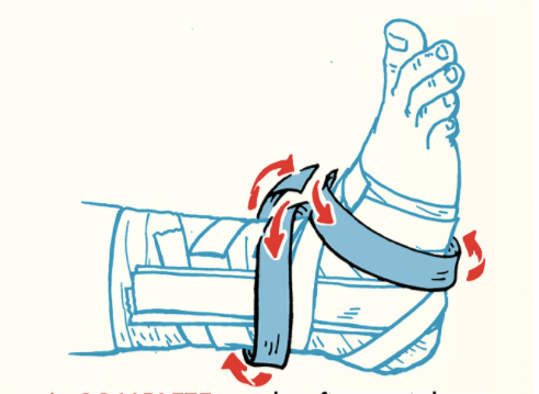 An illustration of a foot with a cast on its ankle.