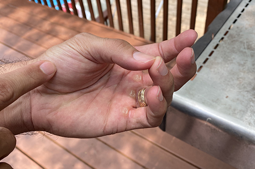 Hand testing for medium to medium well steak