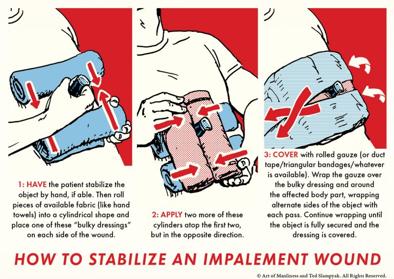 How to Treat an Impalement Wound The Art of Manliness