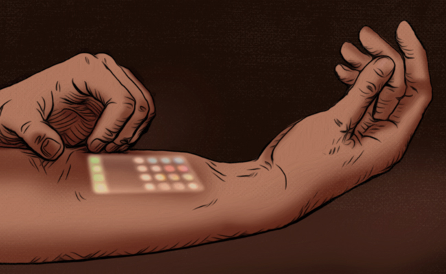 An illustration of a person's arm with an electronic device under their skin.