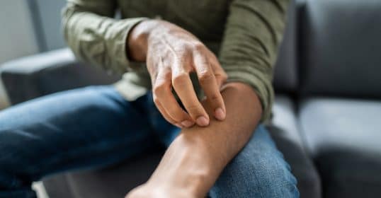 Person scratching their arm while sitting down, pondering if the 7-Year-Itch is real.
